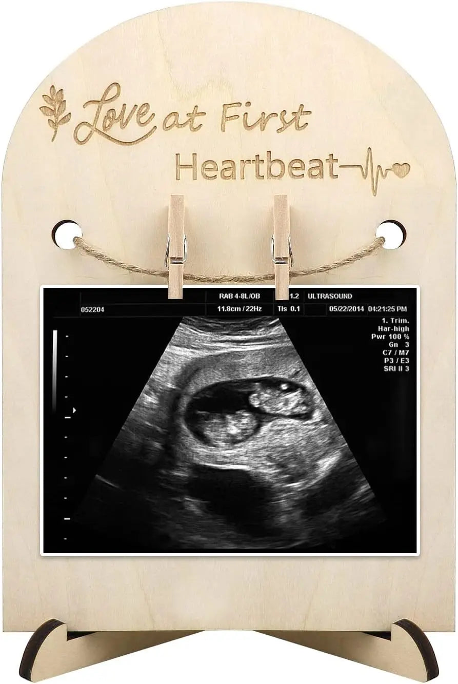 Baby Ultrasound Picture Frame